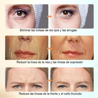 Masajeador Facial Eléctrico EMS con Radiofrecuencia y Fototerapia LED